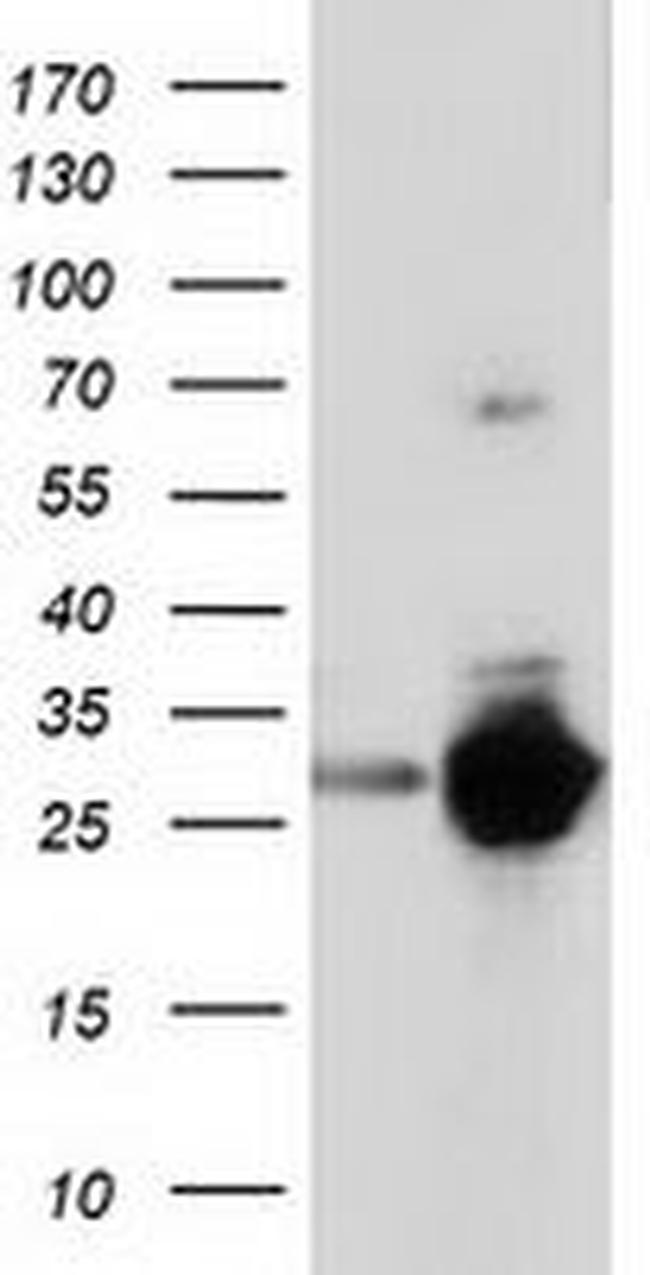 SPR Antibody in Western Blot (WB)