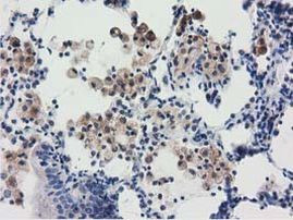 RASD2 Antibody in Immunohistochemistry (Paraffin) (IHC (P))