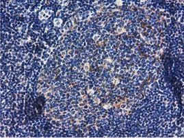 RASD2 Antibody in Immunohistochemistry (Paraffin) (IHC (P))