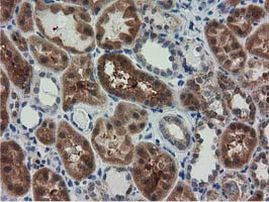 RASD2 Antibody in Immunohistochemistry (Paraffin) (IHC (P))