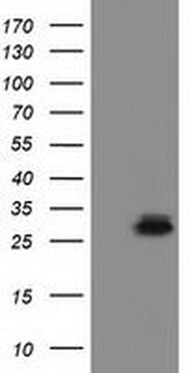 RASD2 Antibody in Western Blot (WB)