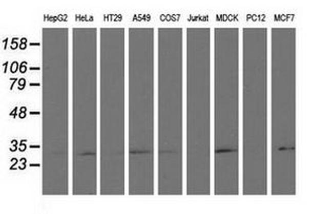 RASD2 Antibody in Western Blot (WB)