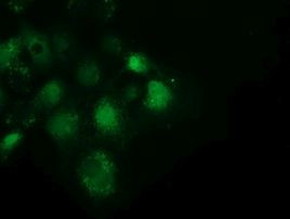 SPR Antibody in Immunocytochemistry (ICC/IF)