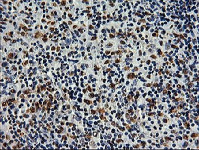 SAMHD1 Antibody in Immunohistochemistry (Paraffin) (IHC (P))