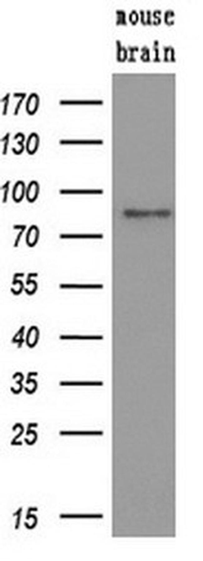 SAMHD1 Antibody in Western Blot (WB)