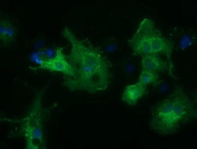 HDAC6 Antibody in Immunocytochemistry (ICC/IF)