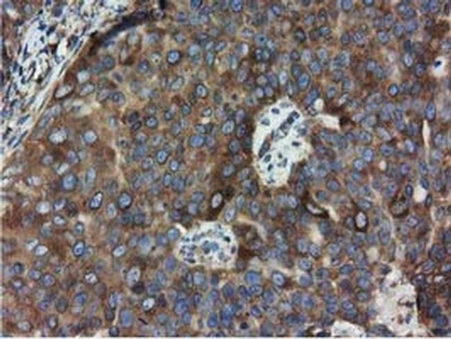 HDAC6 Antibody in Immunohistochemistry (Paraffin) (IHC (P))