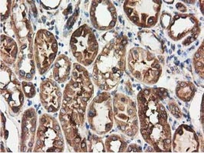 HDAC6 Antibody in Immunohistochemistry (Paraffin) (IHC (P))