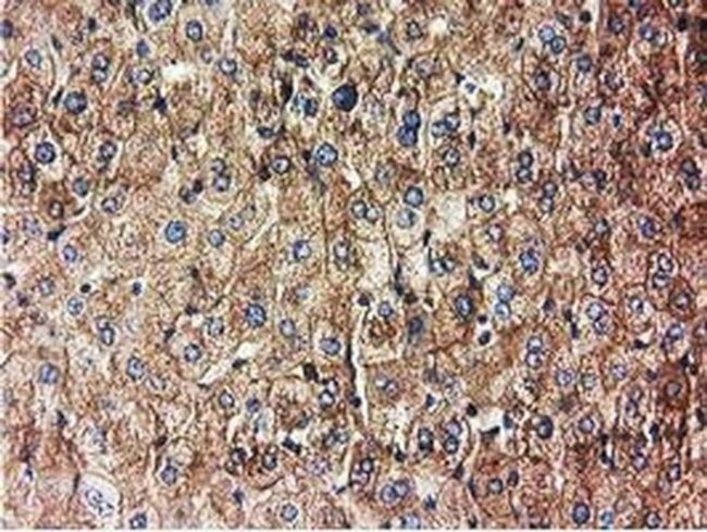 HDAC6 Antibody in Immunohistochemistry (Paraffin) (IHC (P))