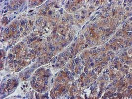 PYCRL Antibody in Immunohistochemistry (Paraffin) (IHC (P))