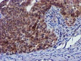 PYCRL Antibody in Immunohistochemistry (Paraffin) (IHC (P))