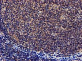 PYCRL Antibody in Immunohistochemistry (Paraffin) (IHC (P))