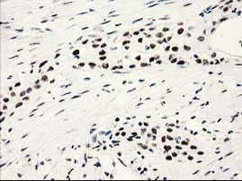 PYCRL Antibody in Immunohistochemistry (Paraffin) (IHC (P))