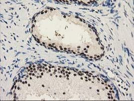 PYCRL Antibody in Immunohistochemistry (Paraffin) (IHC (P))