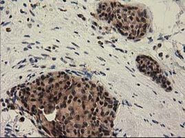 PYCRL Antibody in Immunohistochemistry (Paraffin) (IHC (P))