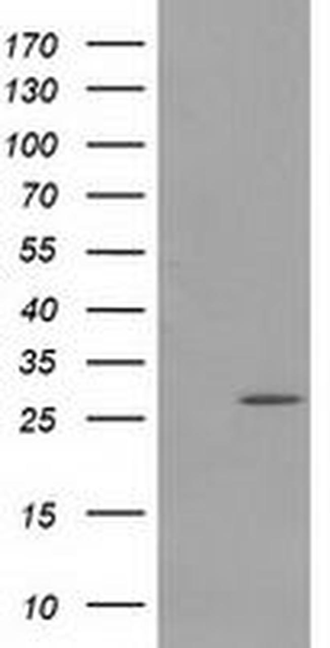 PYCRL Antibody in Western Blot (WB)