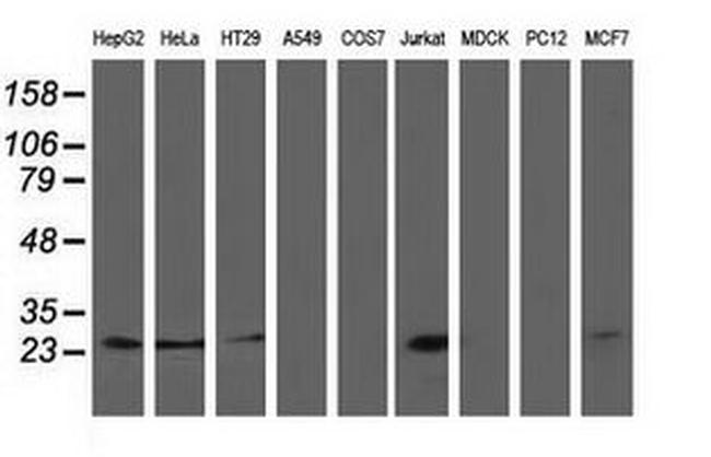 PYCRL Antibody in Western Blot (WB)