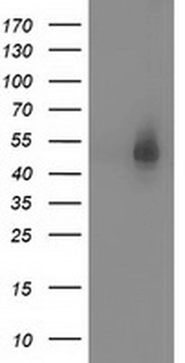 Syntrophin alpha-1 Antibody in Western Blot (WB)