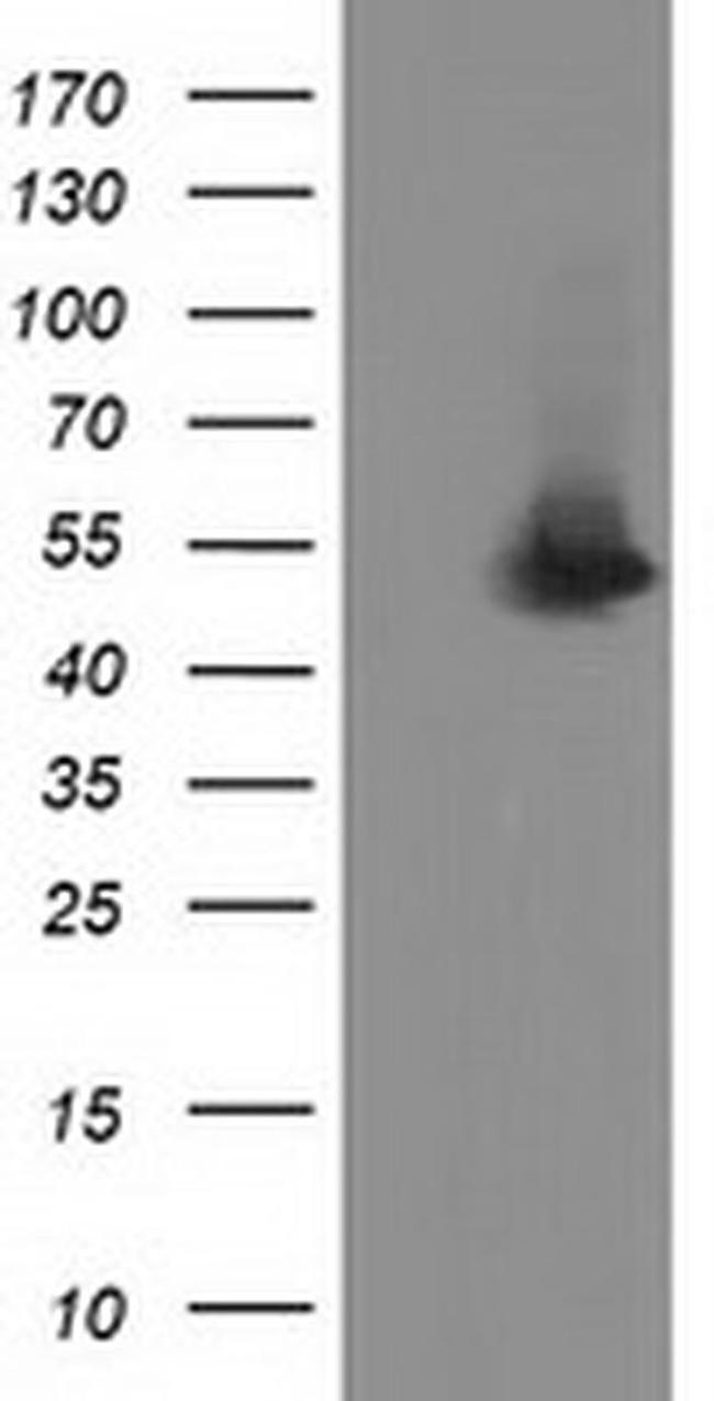 Syntrophin alpha-1 Antibody in Western Blot (WB)