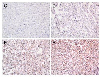 Annexin A3 Antibody in Immunohistochemistry (Paraffin) (IHC (P))