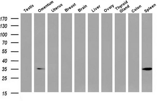 Annexin A3 Antibody in Western Blot (WB)