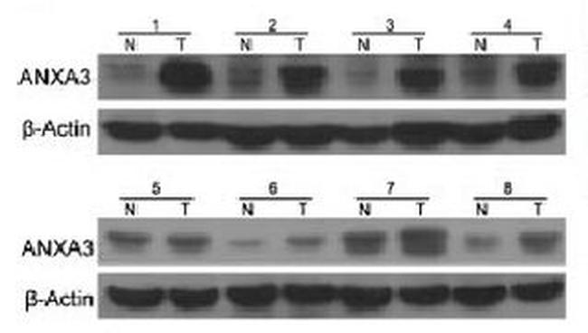 Annexin A3 Antibody in Western Blot (WB)