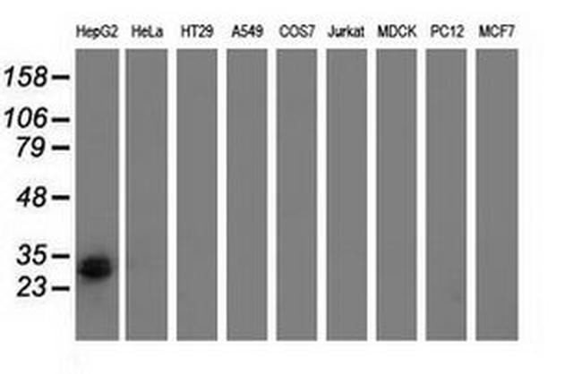 RASD2 Antibody in Western Blot (WB)