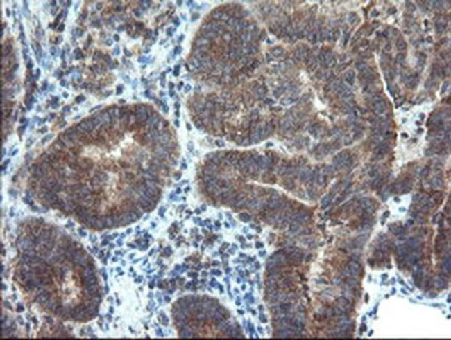 DUPD1 Antibody in Immunohistochemistry (Paraffin) (IHC (P))