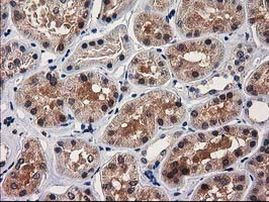 GRHPR Antibody in Immunohistochemistry (Paraffin) (IHC (P))