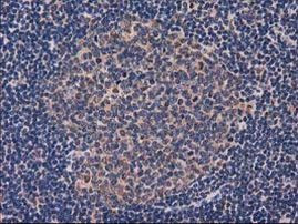 GRHPR Antibody in Immunohistochemistry (Paraffin) (IHC (P))