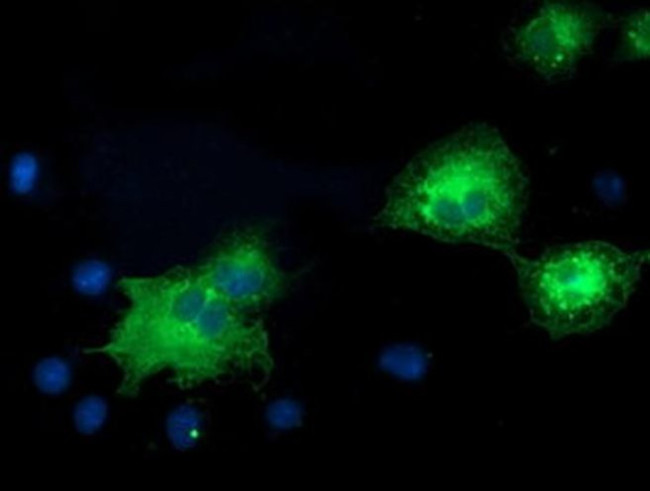 ERK5 Antibody in Immunocytochemistry (ICC/IF)