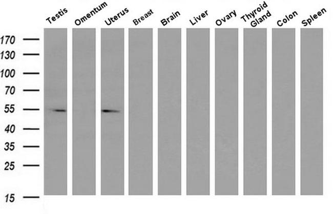 LMAN1 Antibody in Western Blot (WB)