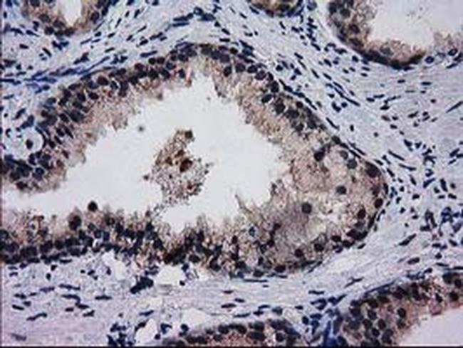 BIN3 Antibody in Immunohistochemistry (Paraffin) (IHC (P))