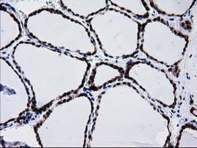 BIN3 Antibody in Immunohistochemistry (Paraffin) (IHC (P))