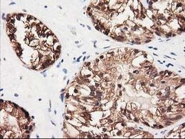 GALE Antibody in Immunohistochemistry (Paraffin) (IHC (P))