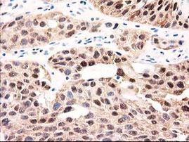 GALE Antibody in Immunohistochemistry (Paraffin) (IHC (P))