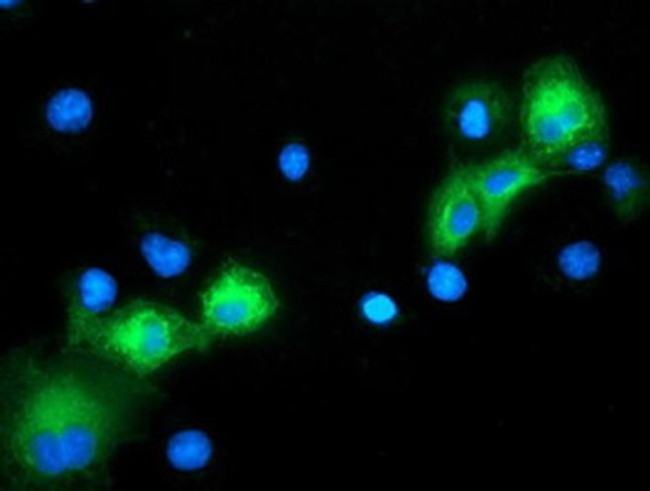 ERK5 Antibody in Immunocytochemistry (ICC/IF)