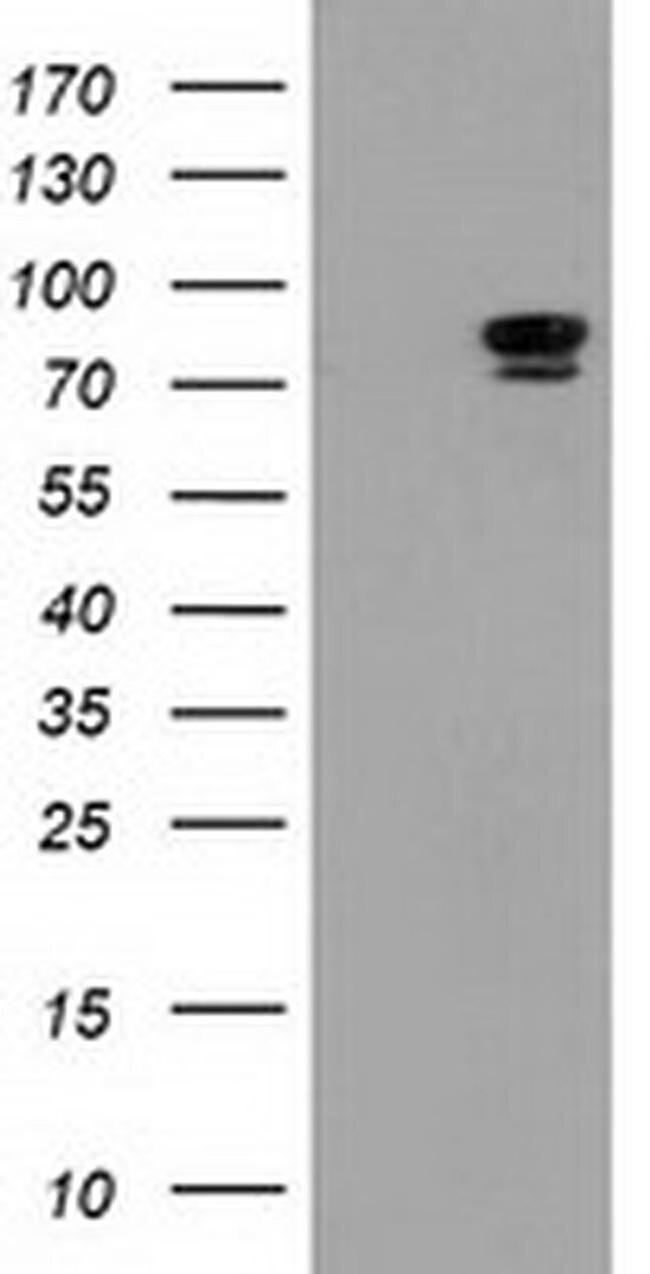 ERK5 Antibody in Western Blot (WB)