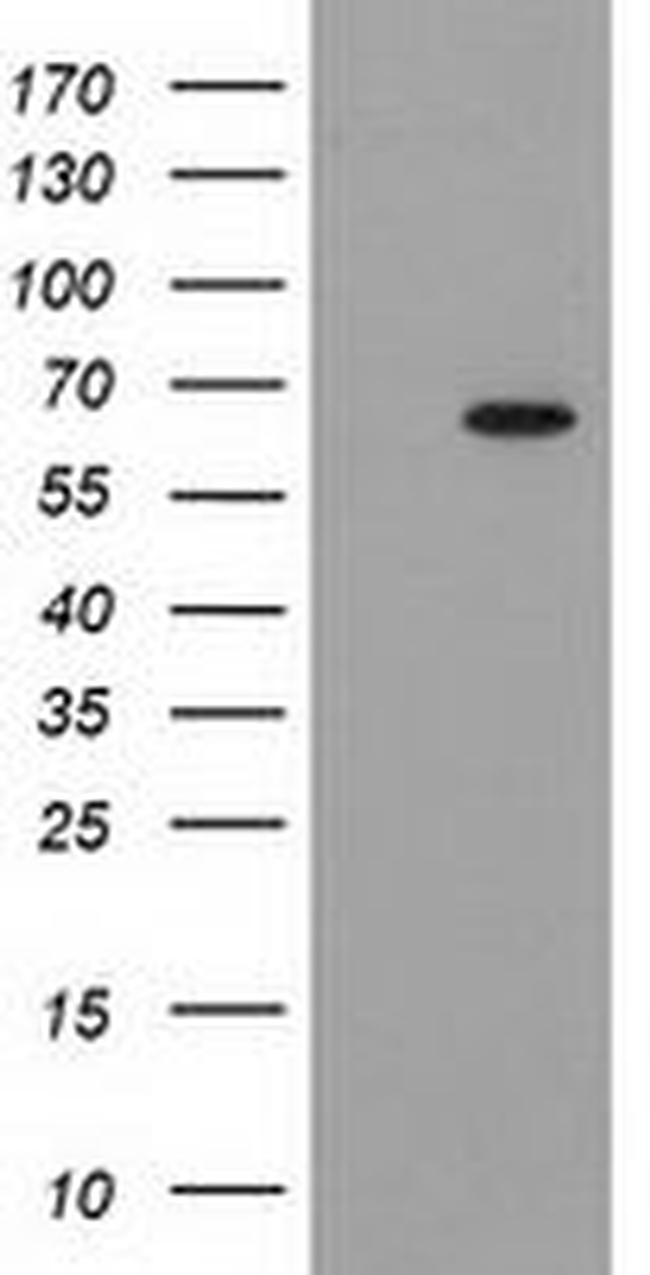 GCKR Antibody in Western Blot (WB)