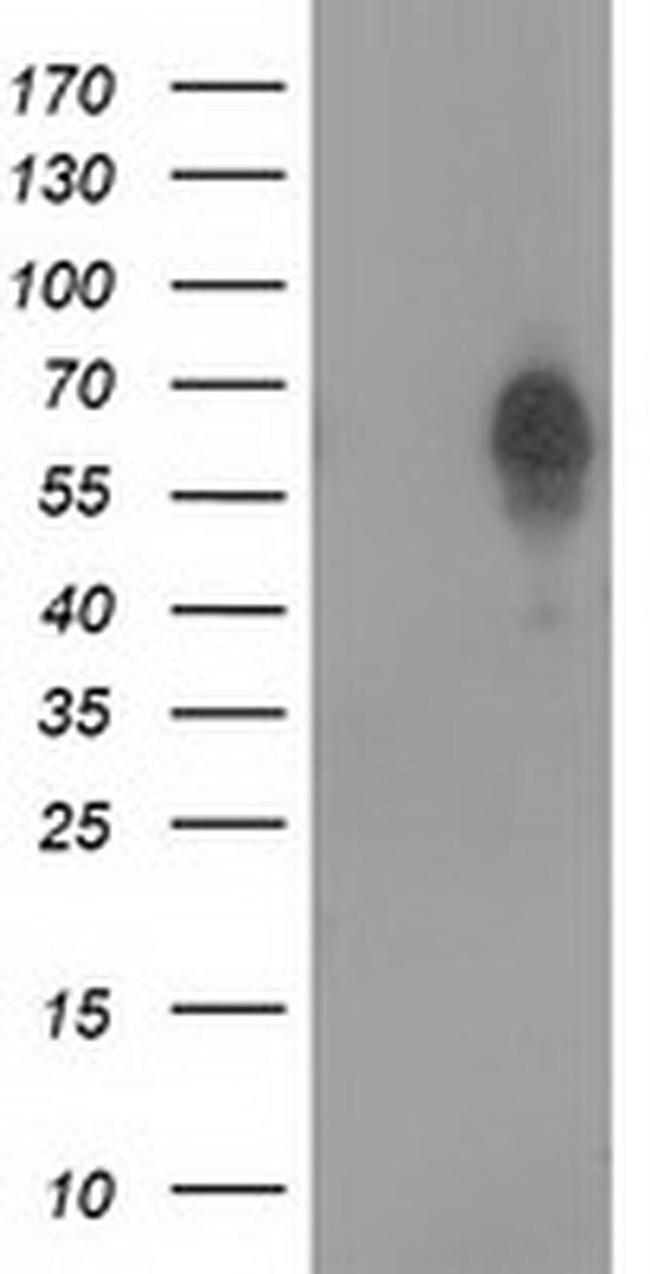 Bestrophin 3 Antibody in Western Blot (WB)