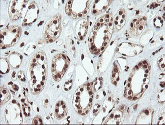 SAMHD1 Antibody in Immunohistochemistry (Paraffin) (IHC (P))