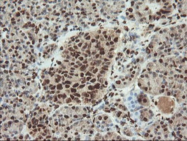 SAMHD1 Antibody in Immunohistochemistry (Paraffin) (IHC (P))