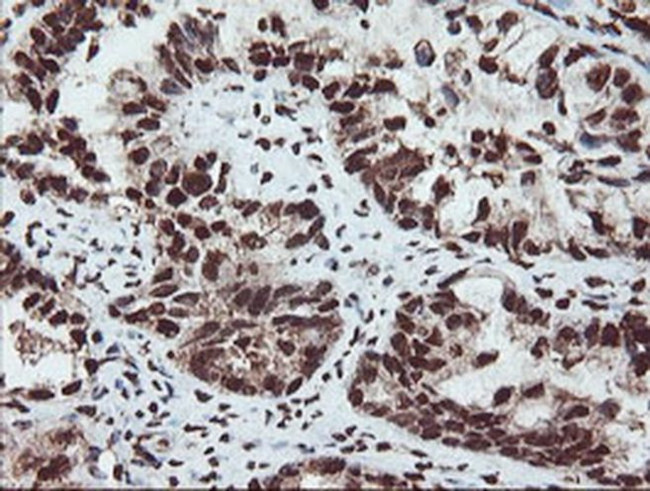 SAMHD1 Antibody in Immunohistochemistry (Paraffin) (IHC (P))