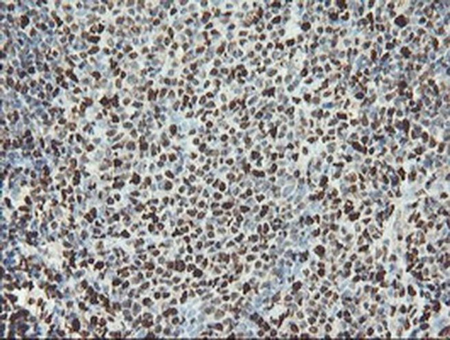 SAMHD1 Antibody in Immunohistochemistry (Paraffin) (IHC (P))