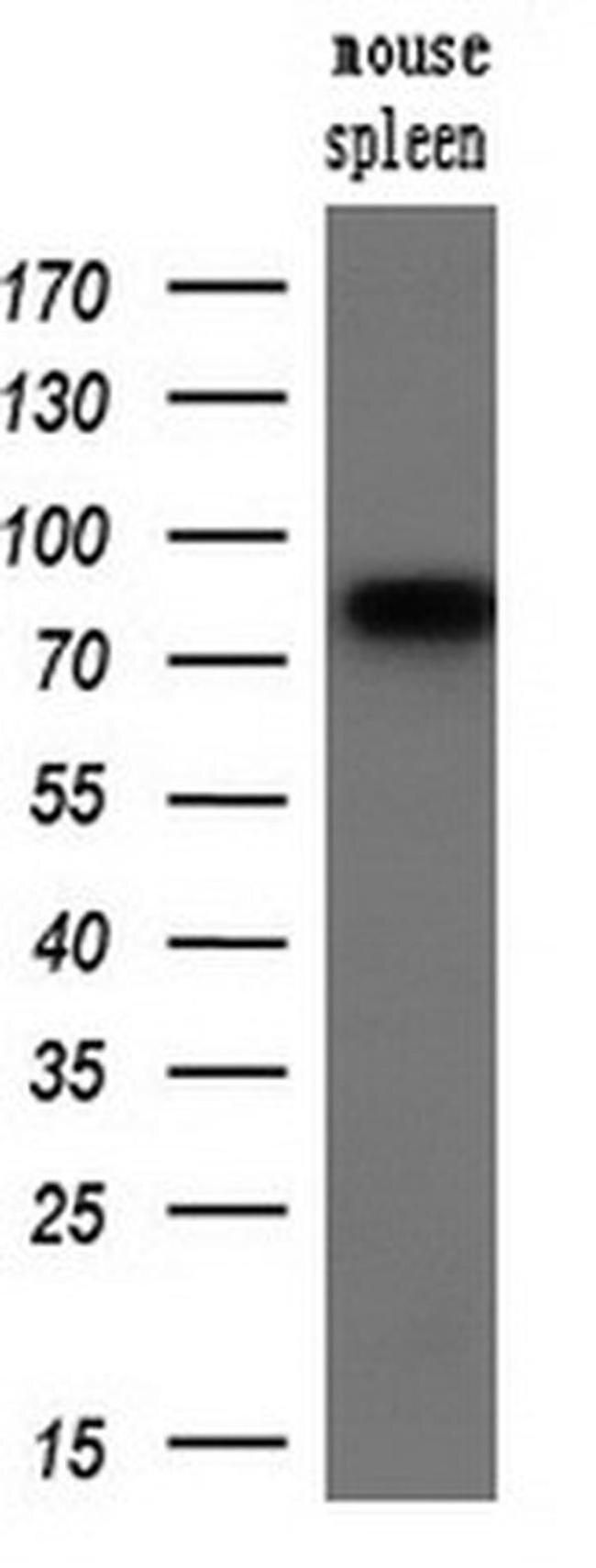 SAMHD1 Antibody in Western Blot (WB)