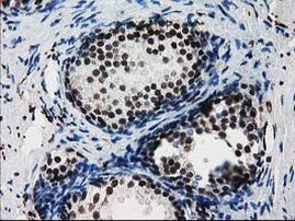 FKBPL Antibody in Immunohistochemistry (Paraffin) (IHC (P))