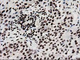 FKBPL Antibody in Immunohistochemistry (Paraffin) (IHC (P))