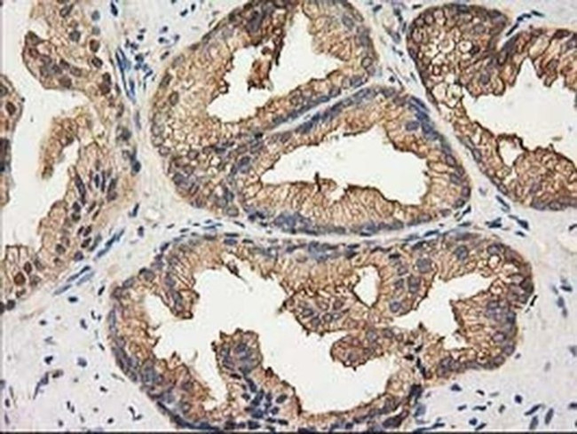 HDAC6 Antibody in Immunohistochemistry (Paraffin) (IHC (P))