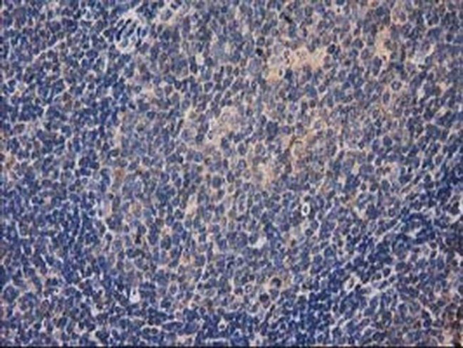 HDAC6 Antibody in Immunohistochemistry (Paraffin) (IHC (P))