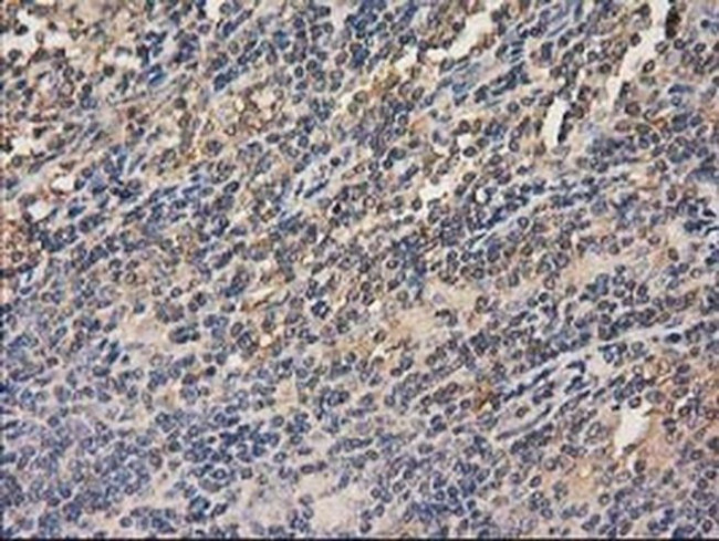 HDAC6 Antibody in Immunohistochemistry (Paraffin) (IHC (P))